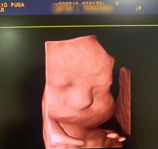 Fertigine | Dr. Dario Puga Aguilar